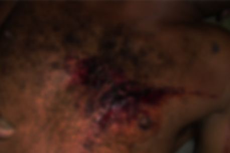 thumb homicidio-pentecostes