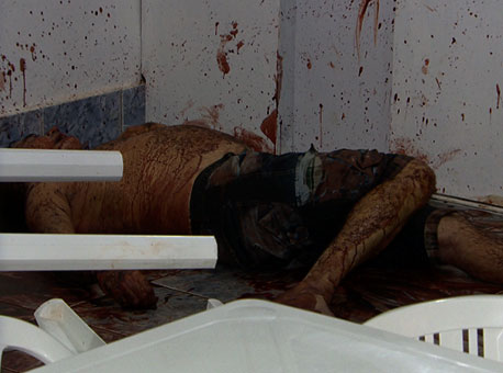 150615-policia-homemdegolado-tvgazeta