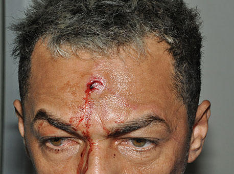 040815-policia-tentativadehomicidio-cleriston