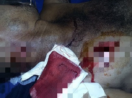 040915-policia-tentativa-homicidio