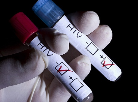 111215-hiv