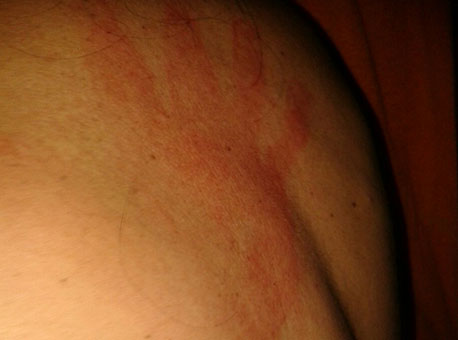 151215-policia-detentasmachucadas-cedida3