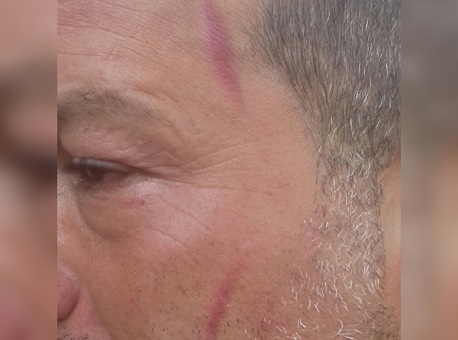 030418-politica-agressao-militante