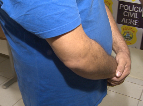 131219-assalto-residencia