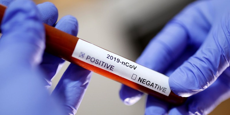 Acre registra três novos casos de covid-19 nesta quarta-feira