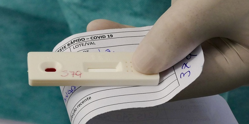 No Acre, nenhum caso ou óbito por covid-19 é registrado nesta sexta-feira