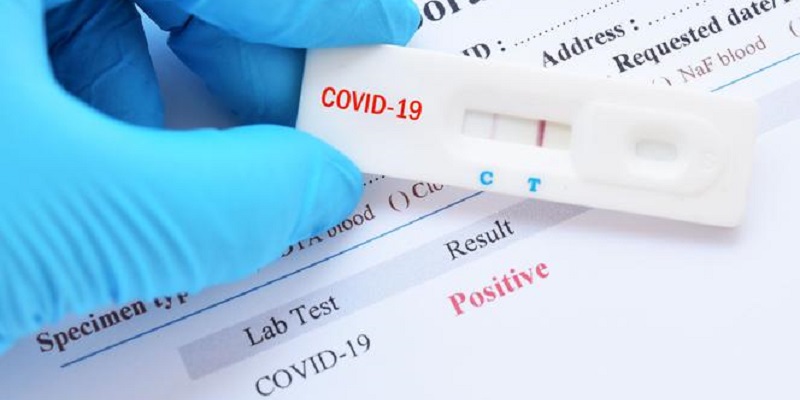 Sem óbitos, Acre registra 166 novos casos de coronavírus neste domingo