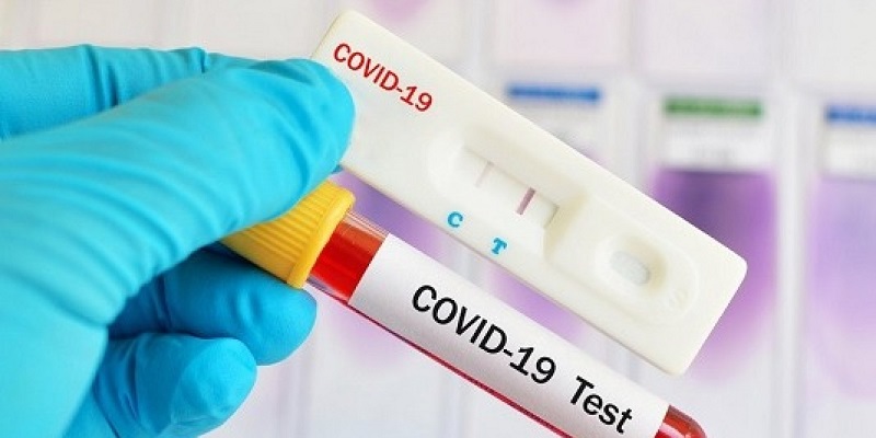 Acre registra 12 casos de covid-19 neste sábado; 62 pessoas estão internadas