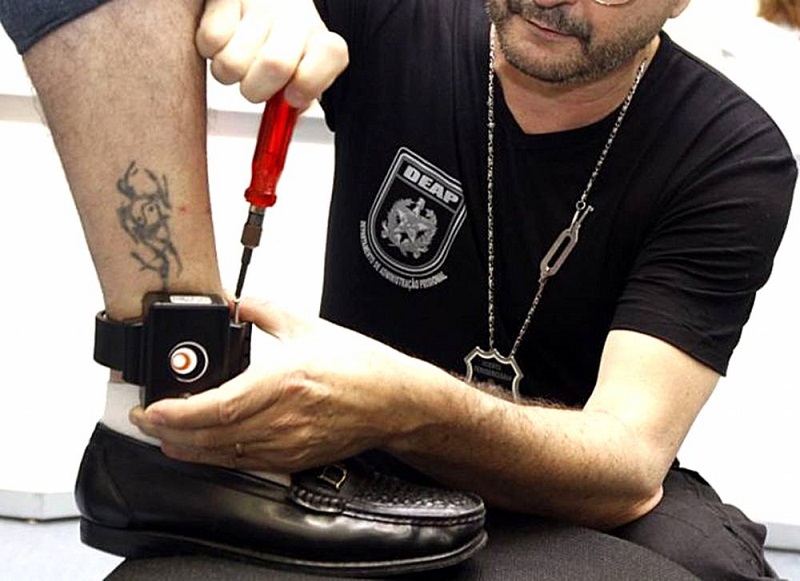 Ministério Público pede que TJAC autorize cirurgias sem tornozeleira