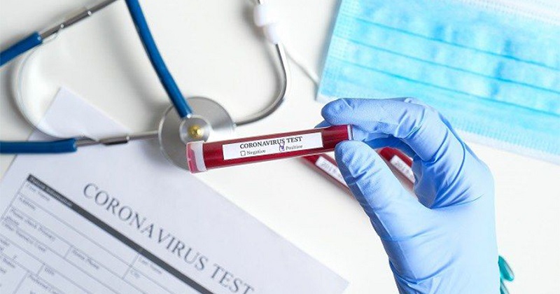 Acre registra 135 novos casos de covid-19 nesta segunda-feira