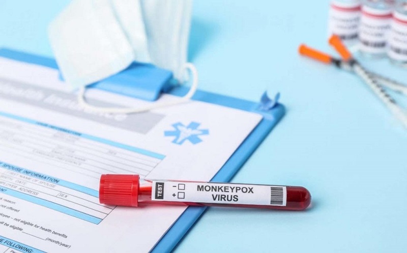 Saúde do Acre notifica quatro novos casos suspeitos de monkeypox