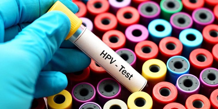 Ufac realiza exame gratuito para detecção de HPV em Rio Branco
