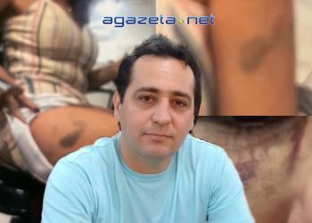 Servidor do Tribunal de Contas da União é suspeito de agredir ex-mulher no Palácio do Comércio em Rio Branco