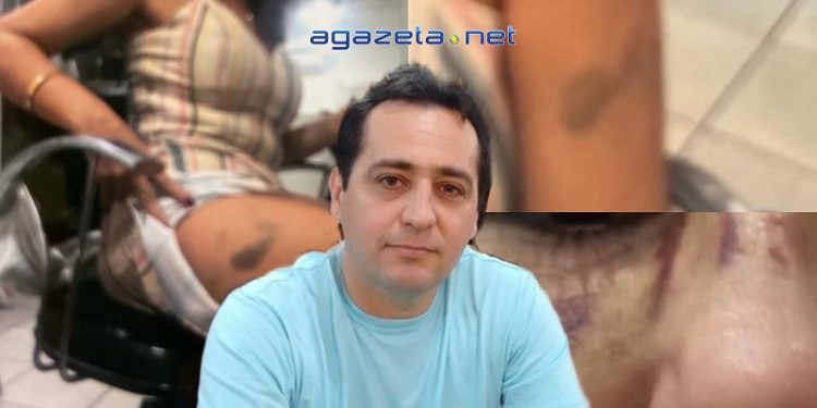 Servidor do Tribunal de Contas da União é suspeito de agredir ex-mulher no Palácio do Comércio em Rio Branco