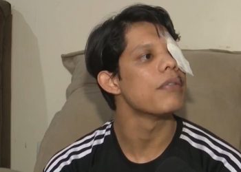 Jovem que perdeu olho após ser agredido com copo de vidro dá primeira entrevista e conta detalhes; confira