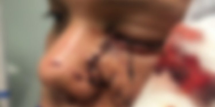 MPAC pede prisão preventiva de empresário que agrediu jovem em Brasileia