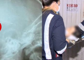 Após dois meses na UTI, morre bebê atingido com tiro na cabeça em ataque na Cidade do Povo