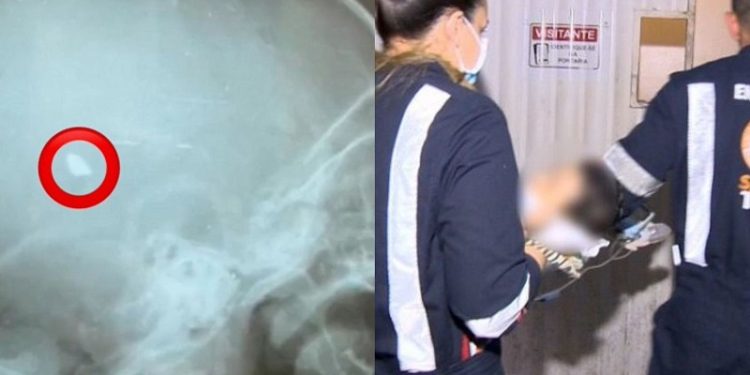 Após dois meses na UTI, morre bebê atingido com tiro na cabeça em ataque na Cidade do Povo