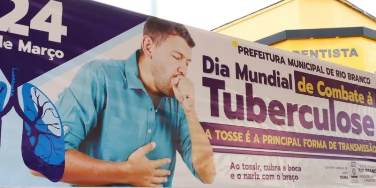 Apesar da redução de 22%, Acre ainda segue entre os estados com a maior taxa de tuberculose do país