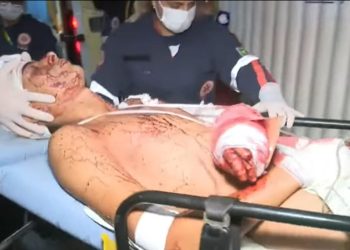 Jovem de 20 anos sofre tentativa de homicídio a golpes de terçado em Senador Guiomard