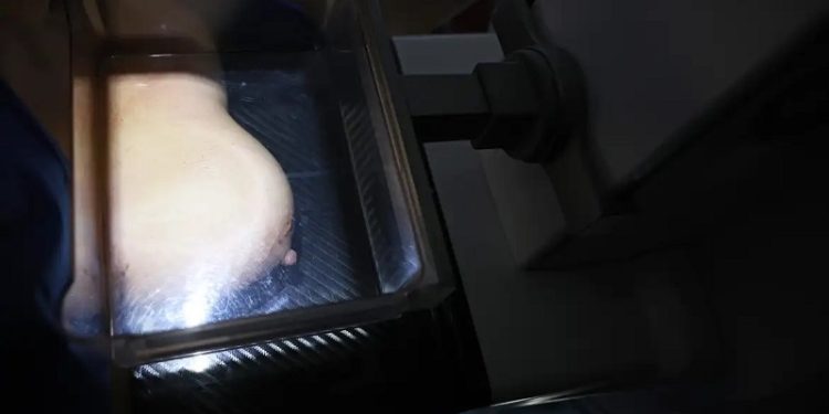 Mulheres de baixa renda terão exames gratuitos de câncer de mama