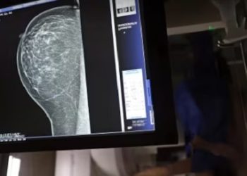 Decreto permite afastamento de servidores e terceirizados para exame preventivo de câncer