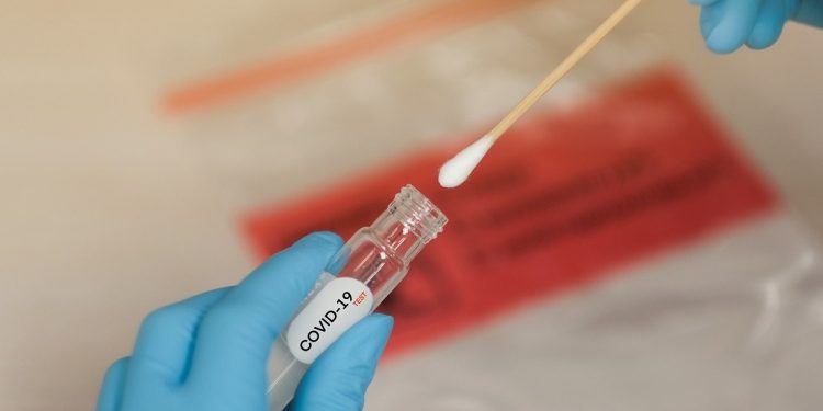 Aumento dos casos de suspeita de Covid-19 gera alta demanda por diagnósticos em Rio Branco