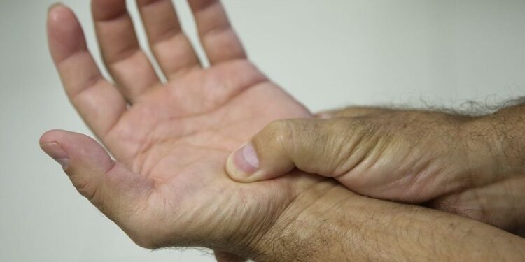 Lei define fibromialgia como deficiência em todo país a partir de 2026