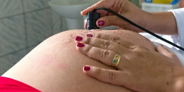 Assistência ao parto avança no Brasil, mas pré-natal ainda preocupa