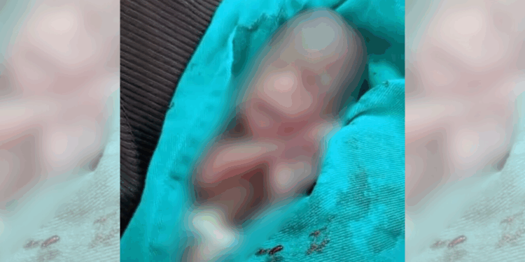 Bebê declarado morto acorda durante o próprio velório após 13 horas dentro de um saco em Rio Branco