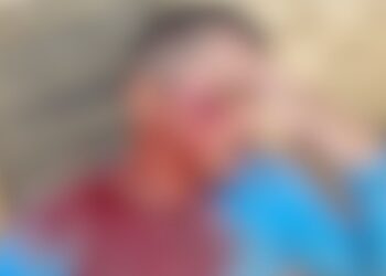 Vereador Joabe Lira cobra punição após gari ser agredido e fraturar o rosto durante coleta em Rio Branco