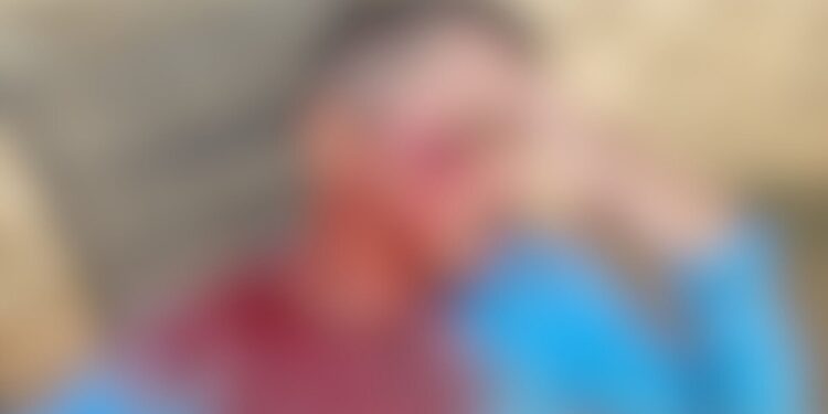 Vereador Joabe Lira cobra punição após gari ser agredido e fraturar o rosto durante coleta em Rio Branco