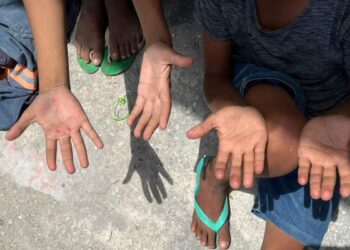 Racismo cresce no Acre e especialistas alertam para subnotificação: “As vítimas têm medo de denunciar”