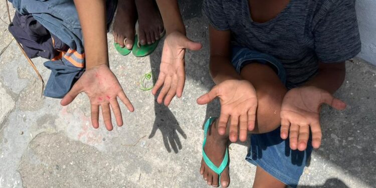 Racismo cresce no Acre e especialistas alertam para subnotificação: “As vítimas têm medo de denunciar”