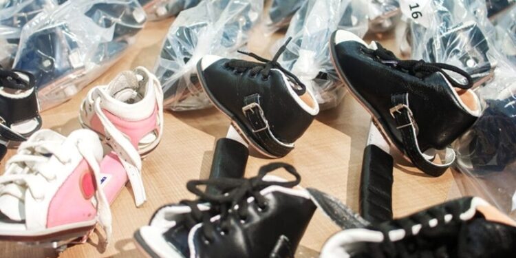 Primeiro banco de órteses para tratamento do Pé Torto Congênito é criado no Acre