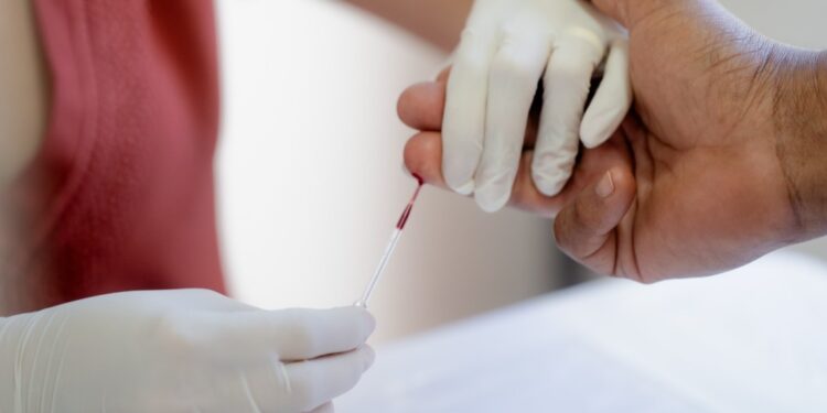 Casos de sífilis ultrapassam 4,5 mil no Acre em três anos, aponta Sesacre