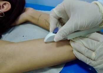 Rio Branco realiza ação de saúde e insere mais de 30 implantes contraceptivos em mulheres em situação de rua