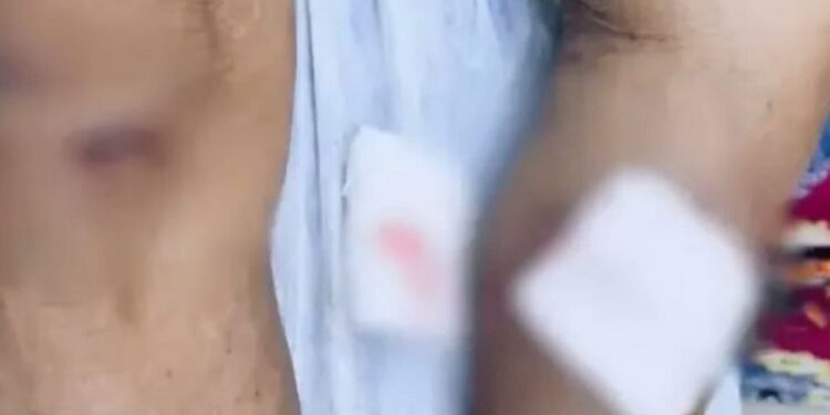 Idoso indígena é atingido por armadilha irregular com disparo de espingarda em Cruzeiro do Sul