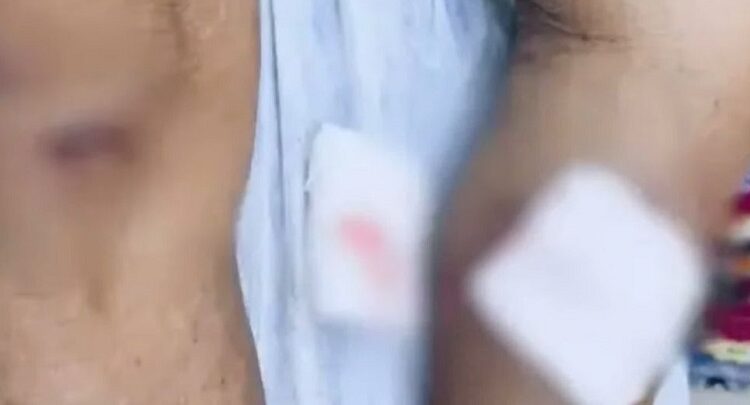 Idoso indígena é atingido por armadilha irregular com disparo de espingarda em Cruzeiro do Sul