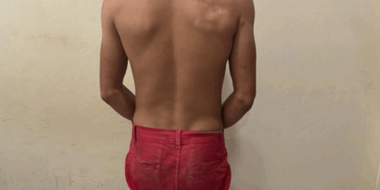 Polícia Civil cumpre mandado de prisão preventiva contra homem que atentou contra ex-companheira