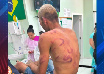 Jovem é espancado por grupo de homens no bairro Manoel Julião